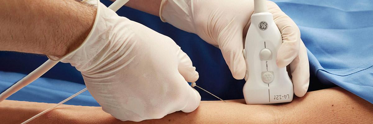 آمنیوسنتز چیست؟