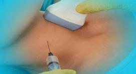 بیوپسی و FNA چیست؟