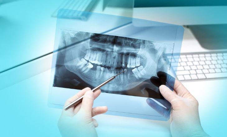 رادیولوژی دندان چیست؟