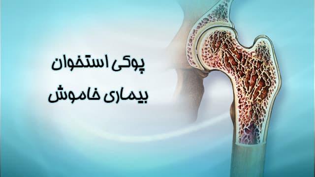 سنجش تراکم استخوان چیست؟ - تصویر شاخص