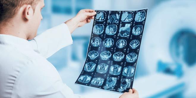 ام آر آی چیست؟