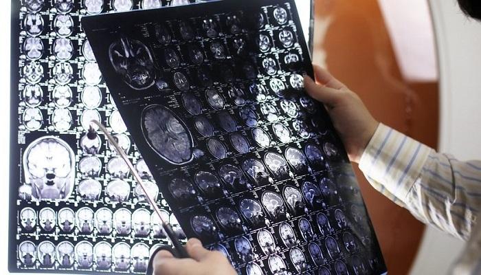 سی تی اسکن چیست؟