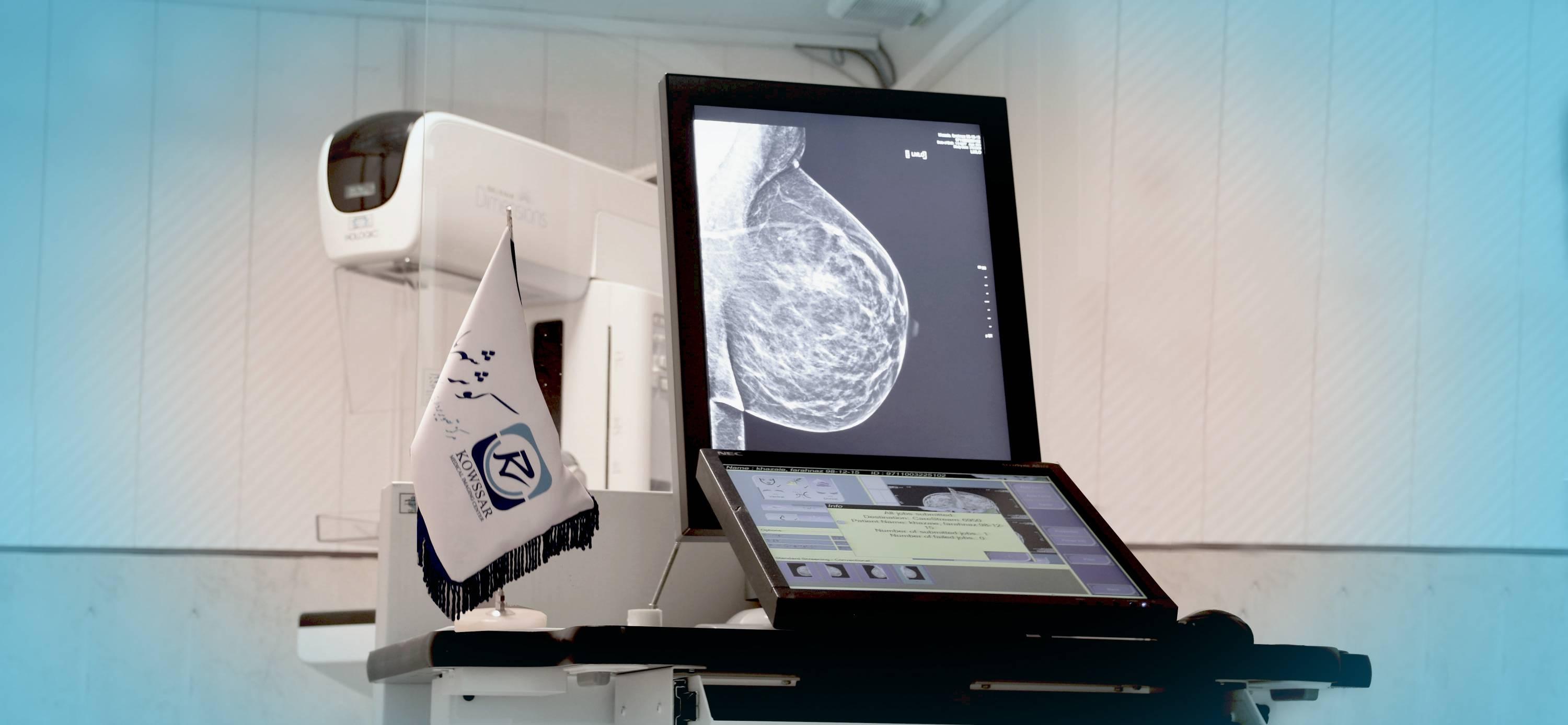 ماموگرافی چیست؟